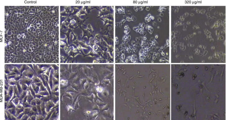 Fig. 2. Morphological changes of MCF-7 and MDA-MB-231 cells treated with different concentrations of the hexane extract of Nepeta binaloudensis for 48 h viewed under inverted phase-contrast microscope (200× magnification)