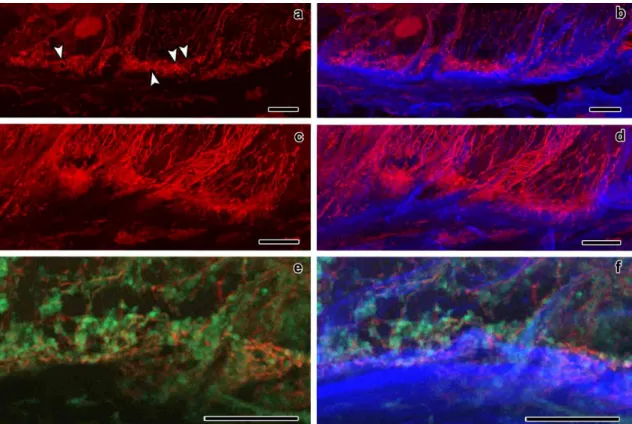 Fig.  2  CLSM  observation  of  longitudinal  sections  of  maize  endosperm  transfer  cells’ 