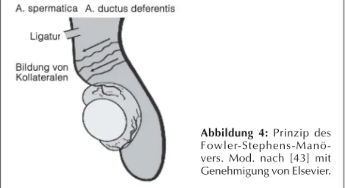 Abbildung 4:  Prinzip des  Fowler-Stephens-Manö-vers. Mod. nach [43] mit Genehmigung von Elsevier.