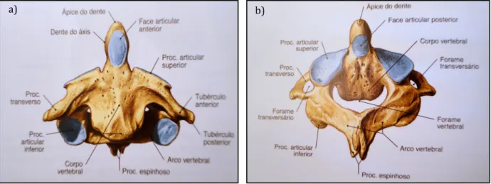 Figura 1.4 - Segunda vértebra cervical, Áxis. a) Vista anterior; b) Vista póstero-superior (Putz e Pabst, 2006)