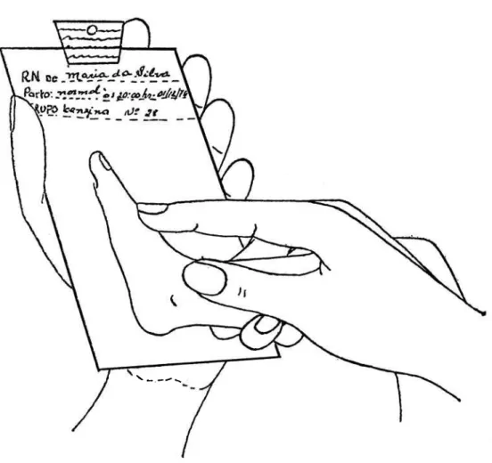 Ilustração  da  tomada  de  uma  impressão  plantar 