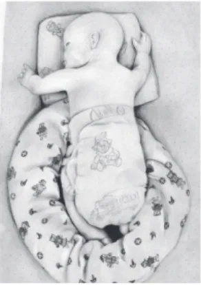 Figure 3 - Semi-prone position