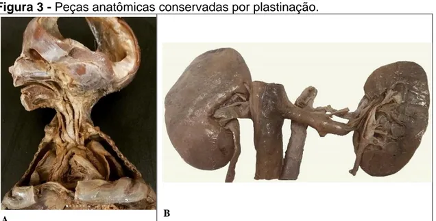 Figura 3 - Peças anatômicas conservadas por plastinação.  