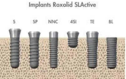 Figura 3- Representação ilustrativa do implante de menor comprimento no  mercado atualmente