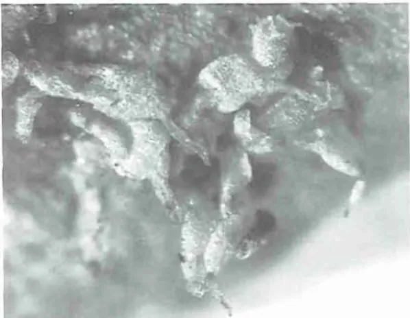 Fig.  4.  Colura  calyptrgolia  (Hook.)  Dum.,  on  old  frond  of  Blechmm  spicant.  -  Magnification  +  x  28