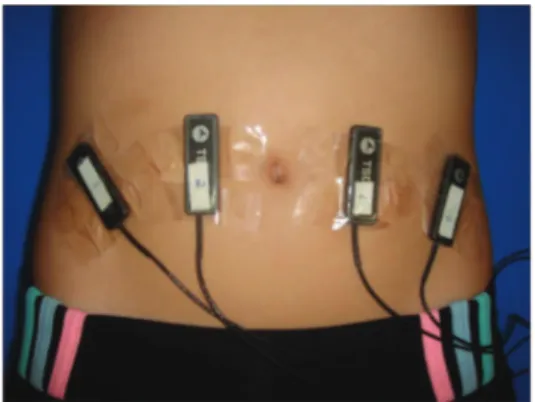 Figure 1 .  Electrodes in place