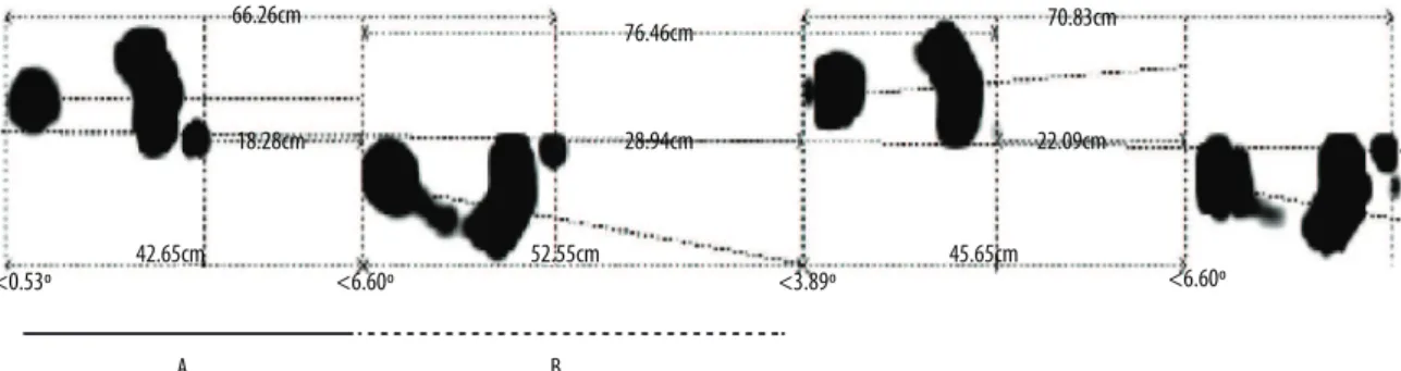 Figure 2. Schematic representation of the image generated by the FootWork Pro software, version 3.2.0.1, used for the calculation of step length.