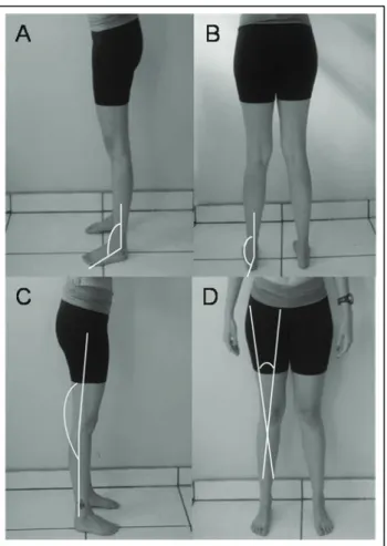 Figure 1. Goniometer positions for the measurement of the: (A) tibiotarsal angle (ankle); (B) subtalar angle  (ankle); (C) lexion-extension angle (knee); and (D) Q-angle (knee).