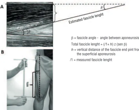 Figure 1. Procedure for FL estimation (A) and Identification of the anatomical site for placement  of the US transducer (B).