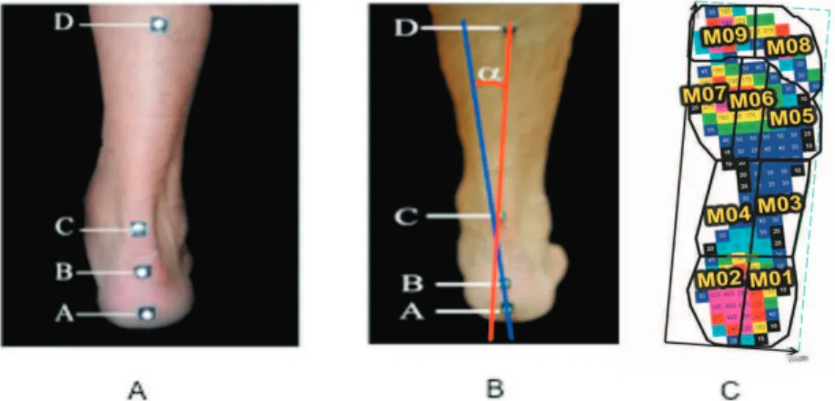 Figure 1 - Location of reference points (A); Relative angle ( α ) between tibiocalcaneal segments (B); 