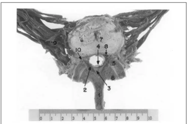 Figura - Seção transversal da terceira vértebra lombar, através das bordas inferiores de dois LA vizinhos, mostrando o formato  tri-angular do canal vertebral