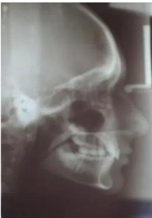 Figura 1- Radiografia Panorâmica  Fonte: o autor. 