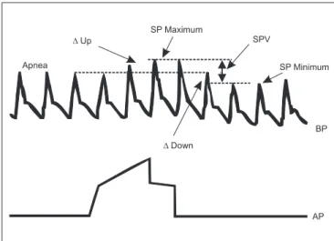 Figure 1 - Schematic of Blood Pressure (BP) and Airway Pressure (AP) Tracing during Positive Pressure Ventilation and in Apnea Systolic Pressure Variation (SPV) is divided into its  compo-nents delta Down (dDown) representing systolic pressure  de-crease, 
