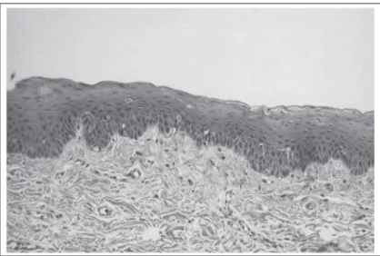 Figure 1 – Stratified Squamous Epithelium