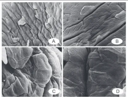Figure 3 – Scanning Electron Microscopy of Normal Vocal Folds In A (465 X) you can see the epithelium surrounded by cells that  are flaking off the surface; in B (785 X) you can see the details  of the pleats on the laryngeal mucous membrane; in C (1,260 X