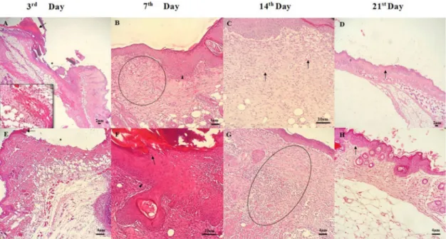 Figure 5. Photomicrographs of skin wounds on 3rd, 7th, 14th, and 21st day of treatment for groups treated with chitosan gel (A–D) and chitosan gel associated with buriti oil (E–H)