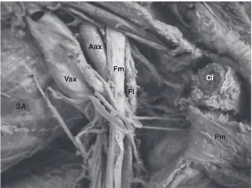Figura 2. Relaciones topográficas de los fascículos del plexo braquial.