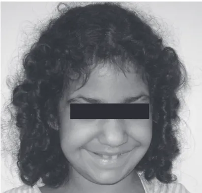 Figure 2. Picture taken after permission from her parents.