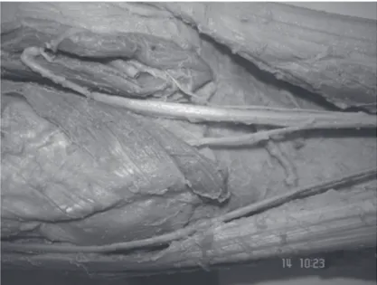 Figura 3 – Estudio en un Cadáver del Laboratorio de Anatomía  Humana de la Universidade Federal de Uberlândia