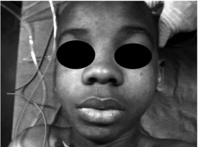 Figure 2 – Patient’s face.