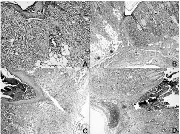 Figure 1 Mild Edema, Inflammation and Vascularity in control (A) and tramadol (B) Groups (H&amp;E, x400, x100) (B)