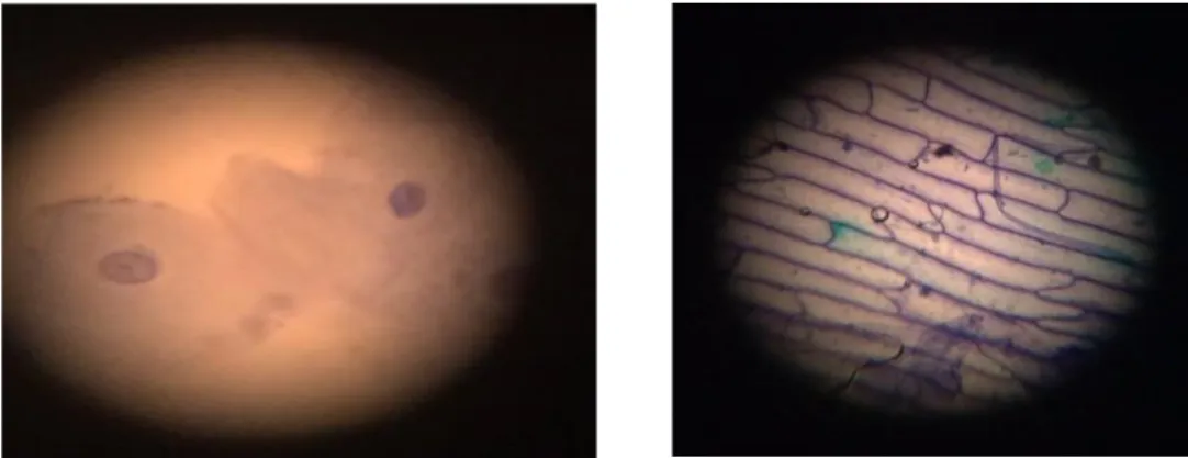 Figura 6. Exemplos de fotografias de células do epitélio lingual e da epiderme da  cebola 