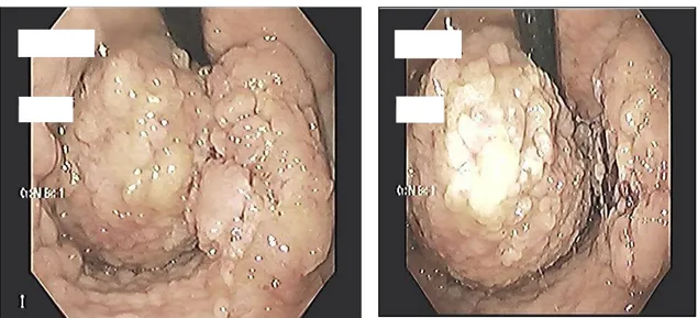 Figura 1 – Endoscopia digestiva. Fonte: os autores.     