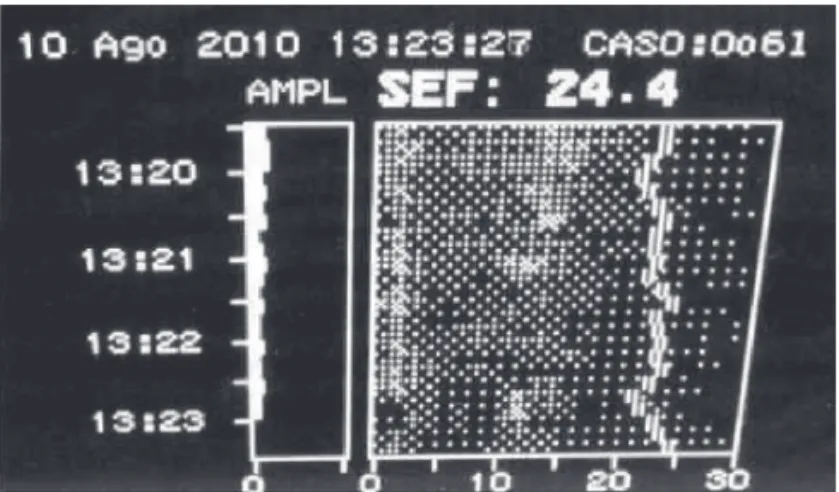 Figure 7 – 95% SEF and Spectral Density.