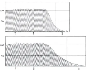Tabla 1   Evaluación de las Condiciones de Intubación  Traqueal. 2
