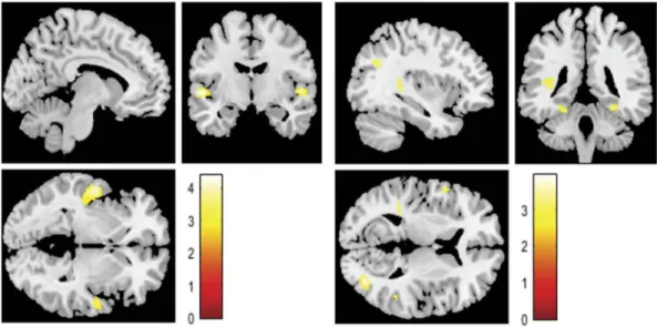 Table 4. Differences in brain activation for positive (> negative) contents expressed by their partner; Voxel Threshold: p ≤ .001;