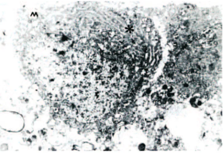 Figure 3  Neuron Electron Microscopic Examination in the  Group which was Subjected to Single Dose of Magnesium  Sulphate