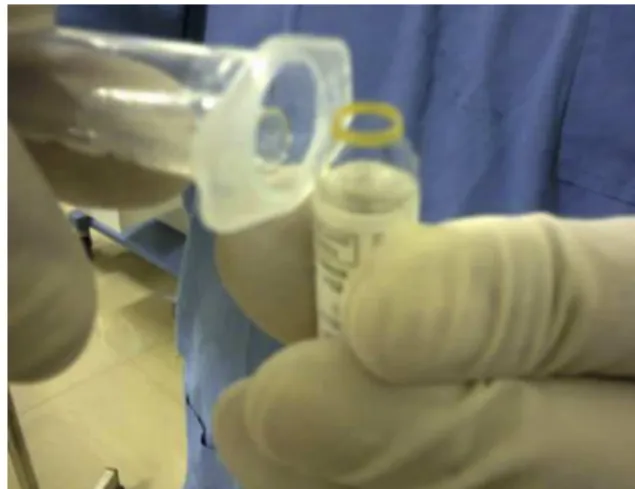 Figure 1 Inserting the conical tip of the ampoule inside the hollow cylindrical space of the barrel