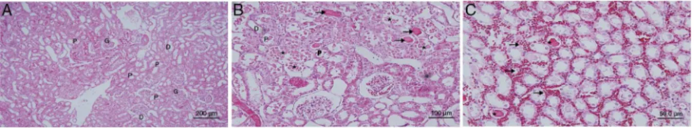 Figura 2 (A) Cortes del grupo isquemia-reperfusión. D: túbulo distal; G: glomérulo; P: túbulo proximal; ( → ) acumulación de material proteico en los túbulos; (*): células epiteliales del túbulo proximal vertidas a la luz