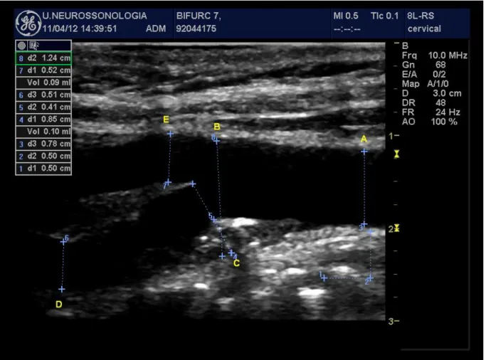 Figura 31 - Imagem Doppler com as dimensões atribuídas à bifurcação 7. 