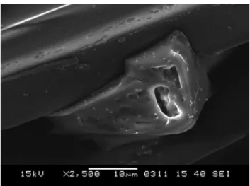 Figure 2 SEM-Portex Flat Filter; Granular structure 5000 × magnification, before bacterial infusion.