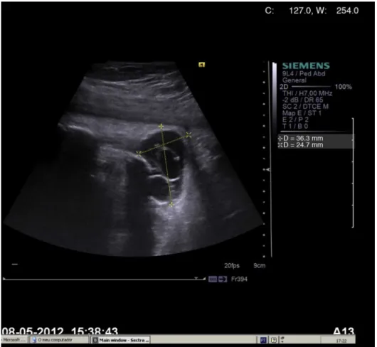Figure 1 Prenatal ultrasound.