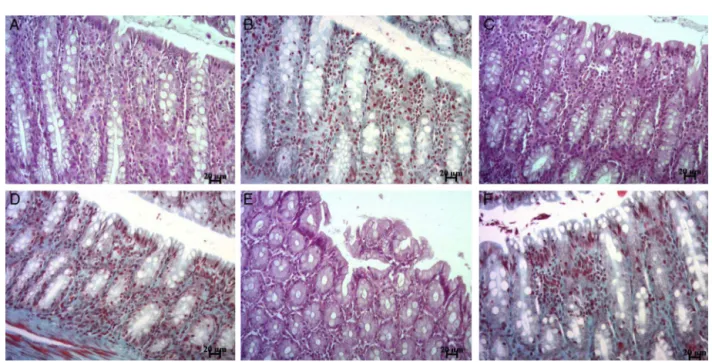 Figure 1 Representative micrographs of rat colon sections stained with hematoxylin---eosin (A, C, E) or Masson’s trichrome (B, D, F)