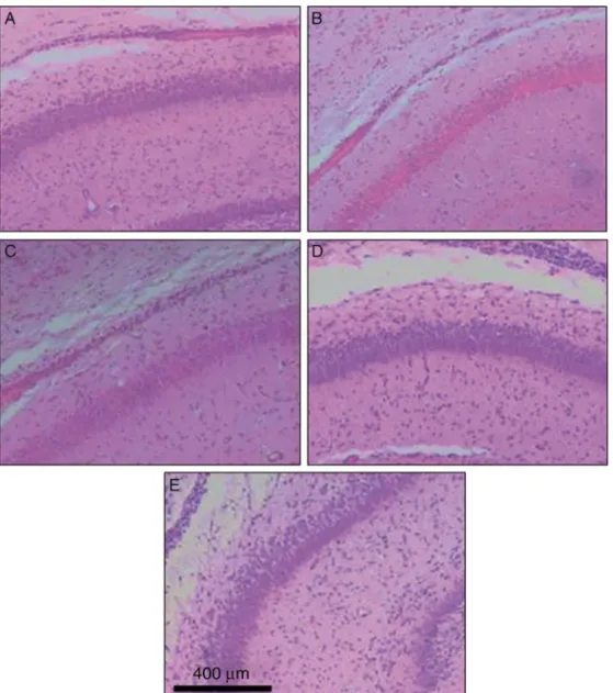 Figure 2 HE staining of hippocampal slices. (A) normoxia control; (B) hypoxia (Hx); (C) Hx-isoflurane 0.5%; (D) Hx-isoflurane 1.5%;