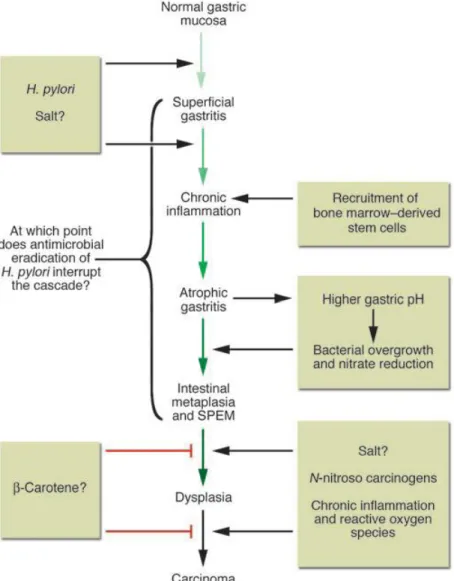 Figura  4  -  Caminho  proposto  por  Correa  dos  eventos  patológicos  no  adenocarcinoma  gástrico  [ Fox e Timothy (2007) ] 