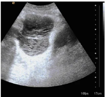 Figure 3 The abdominal USG.