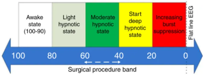 Figure 1 BIS scaling band to indicate DOH level.