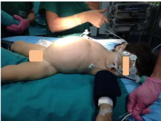Figure 1 Infant after anesthetic induction.