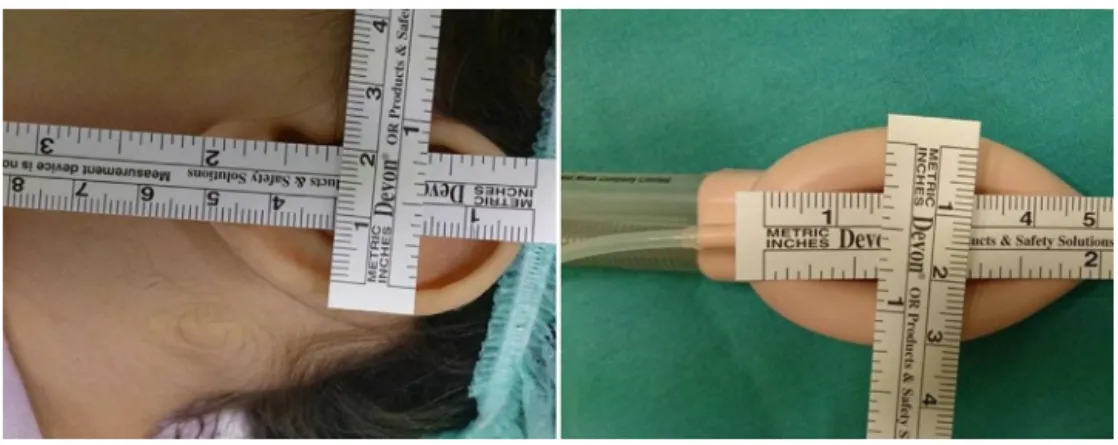 Figure 1 Size of the PLMA.