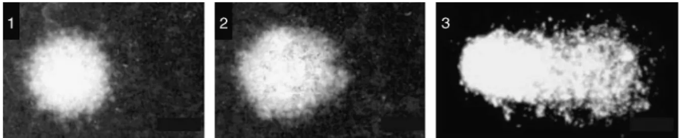 Figure 1 Representative images of comet test on lymphocytes showing progressively larger DNA damage (from 1 to 3).