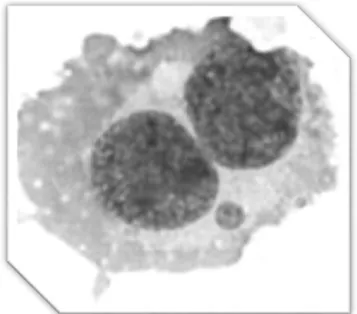 Figure 2 Photomicrography of binucleated cell (lymphocyte) containing one micronucleus.