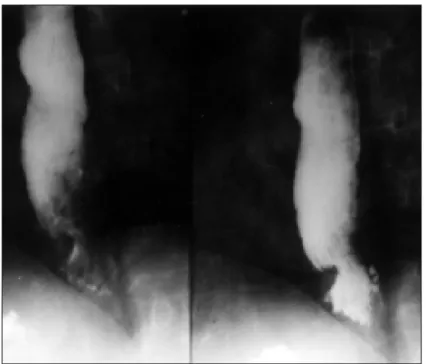 Figura 2. Radiografia do cotovelo esquerdo.