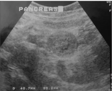 Figura 1. Ultra-sonografia do abdome. Figura 2. Tomografia computadorizada do abdome.