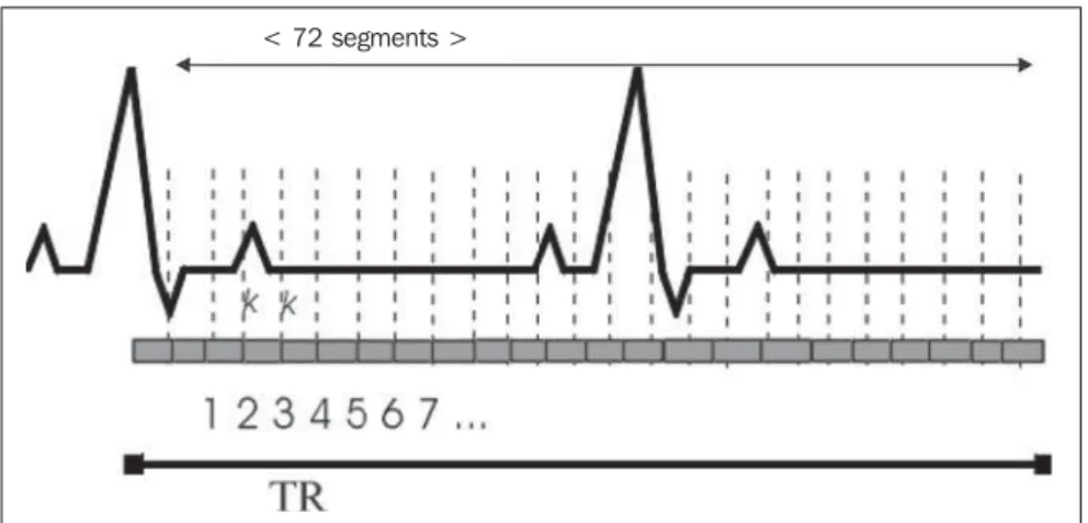 Figure 1. Schematic diagram showing segmented TrueFISP sequences ECG-gating and TR-gating, dem- dem-onstrating k-spaces and mean number of segments
