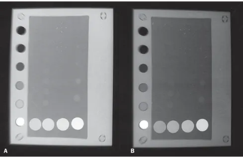 Table 2 Comparison between doses and tube load (kVp x mAs) produced by radiographic techniques obtained in this study and by HCFMB-Unesp clinical routine.