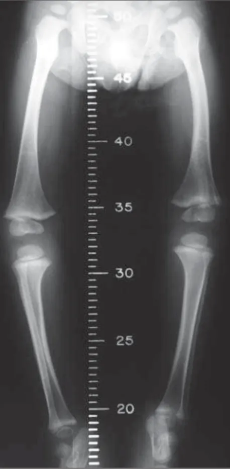 Figura 4. Tomografia computadorizada.